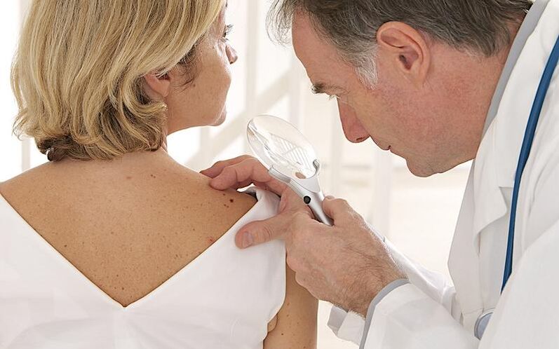 A woman with a papilloma on examination by a doctor before taking Removio gel